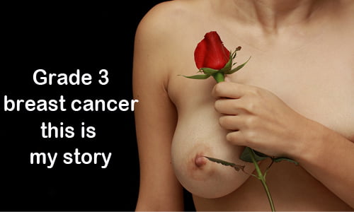 Grade 3 Breast Cancer. I Share My Journey As I Fight Through It!